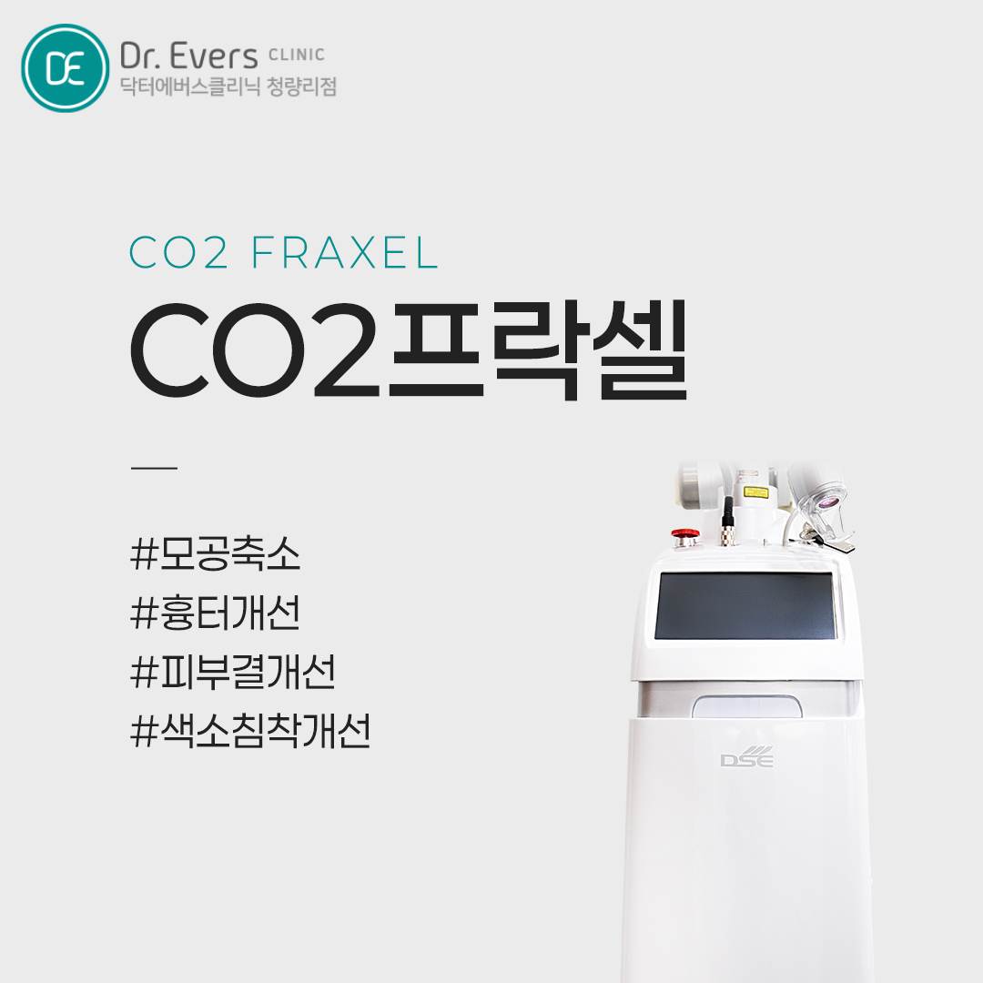 청량리 여드름 흉터 CO2프락셀 포텐자 효과 분석 닥터에버스의원 청량리점